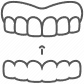 Invisalign